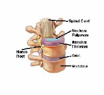 Graphic of Vertebrae and Disc